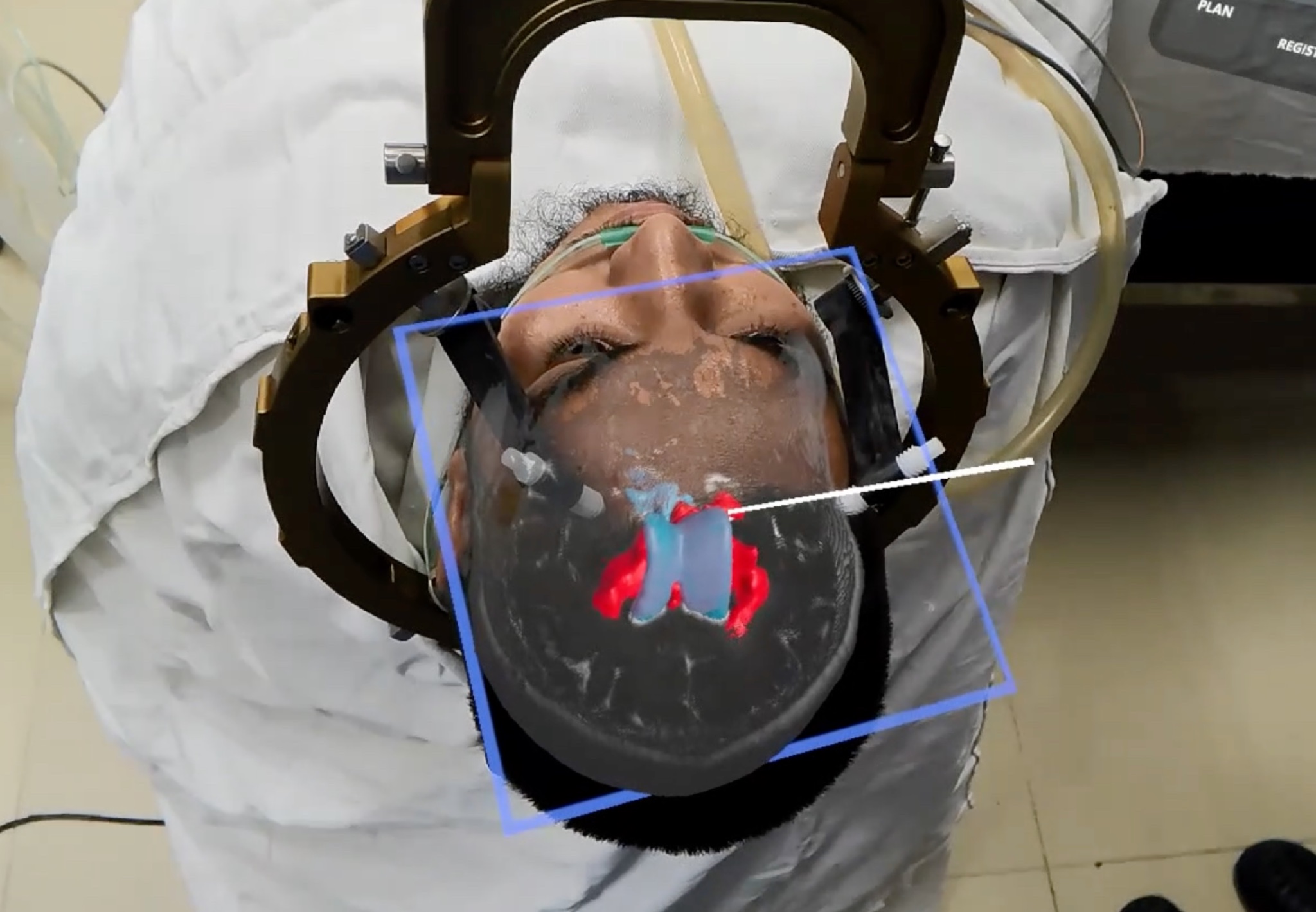 Sub-Millimeter Spatial Registration