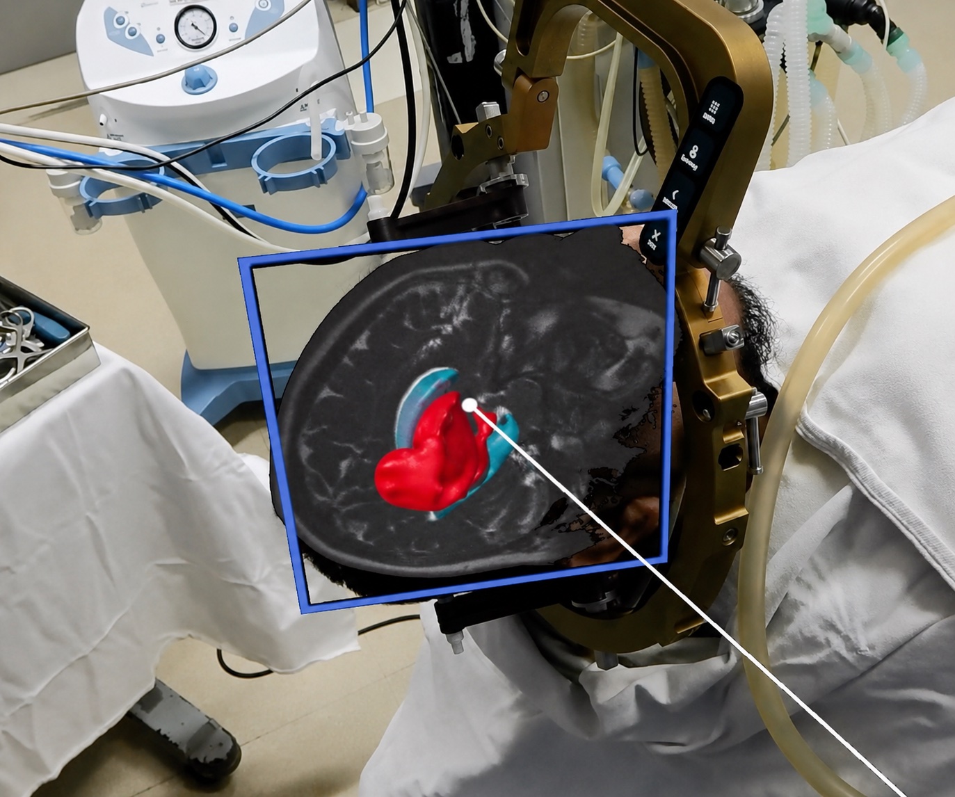 ArNav holographic anatomy overlay
